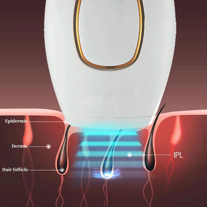 SmoothSilk Home Laser Hair Remover
